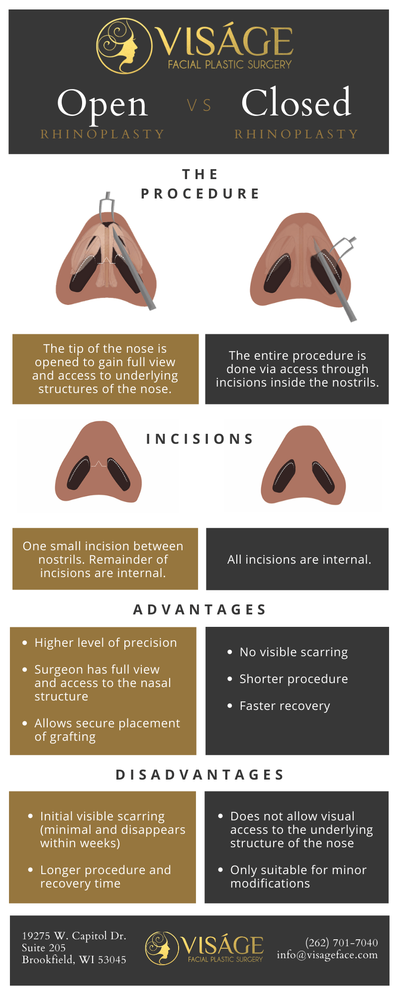 Open vs. Closed Rhinoplasty What Is The Difference